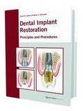 Cover: The Restoration of Dental Implants with Fixed Prosthesis - Quintessence Publishing Co Ltd