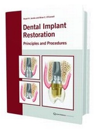 Enlarge image Cover: The Restoration of Dental Implants with Fixed Prosthesis - Quintessence Publishing Co Ltd