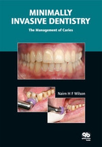 Enlarge image Cover: Minimally Invasive Dentistry - Quintessence Publishing Co Ltd