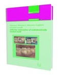 Cover: Adhesive Restoration of Endodontically Treated Teeth - Quintessence Publishing Co Ltd