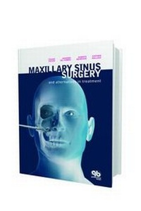 Enlarge image Cover: Maxillary Sinus Surgery and Alternatives in Treatment - Quintessence Publishing Co Ltd