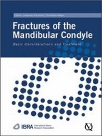 Enlarge image Cover: Fractures of the Mandibular Condyle - Quintessence Publishing Co Ltd