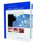 Cover: Peri-Implant Infection Etiology - Quintessence Publishing Co Ltd