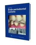 Cover: Endo-periodontal Lesion - Quintessence Publishing Co Ltd