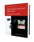 Cover: Practical Implant Dentistry - Quintessence Publishing Co Ltd