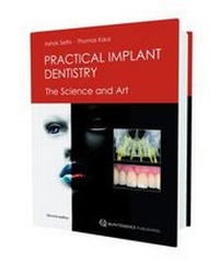 Enlarge image Cover: Practical Implant Dentistry - Quintessence Publishing Co Ltd