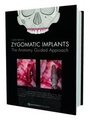 Cover: Zygomatic Implant - Quintessence Publishing Co Ltd