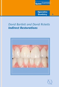 Abbildung von: Indirect Restorations - Quintessence Publishing Co. Ltd.