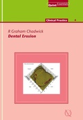 Cover: Dental Erosion - Quintessence Publishing Co. Ltd.