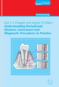 Cover: Understanding Periodontal Diseases: Assessment and Diagnostic Procedures in Practice - Quintessence Publishing Co. Ltd.