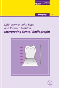 Enlarge image Cover: Interpreting Dental Radiographs - Quintessence Publishing Co. Ltd.