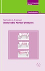 Cover: Removable Partial Dentures - Quintessence Publishing Co. Ltd.
