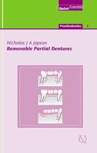 Abbildung von: Removable Partial Dentures - Quintessence Publishing Co. Ltd.