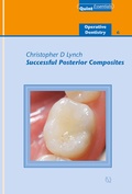 Cover: Successful Posterior Composites - Quintessence Publishing Co. Ltd.
