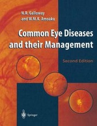 Abbildung von: Common Eye Diseases and their Management - Springer