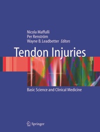 Abbildung von: Tendon Injuries - Springer