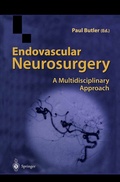 Bild: Endovascular Neurosurgery - Springer