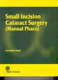 Cover: Small Incision Cataract Surgery - Alpha Science International Ltd