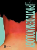 Cover: Photodermatology - Manson Publishing Ltd