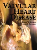 Cover: Valvular Heart Disease - Manson Publishing Ltd