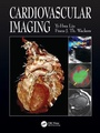Cover: Cardiovascular Imaging - Manson Publishing Ltd
