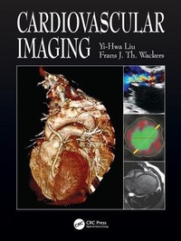 Enlarge image Cover: Cardiovascular Imaging - Manson Publishing Ltd