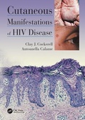 Cover: Cutaneous Manifestations of HIV Disease - Manson Publishing Ltd