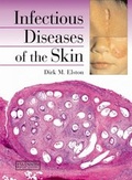 Cover: Infectious Diseases of the Skin - CRC Press