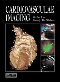 Enlarge image Cover: Cardiovascular Imaging - CRC Press