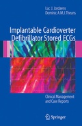 Bild: Implantable Cardioverter Defibrillator Stored ECGs - Springer