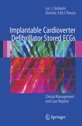Bild: Implantable Cardioverter Defibrillator Stored ECGs - Springer