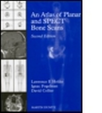 Abbildung von: An Atlas of Planar and SPECT Bone Scans - Taylor & Francis