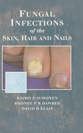 Cover: Fungal Infections of the Skin and Nails - Informa Healthcare