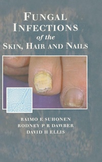 Enlarge image Cover: Fungal Infections of the Skin and Nails - Informa Healthcare