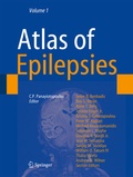 Cover: Atlas of Epilepsies - Springer