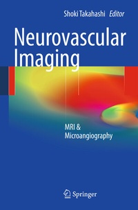 Abbildung von: Neurovascular Imaging - Springer