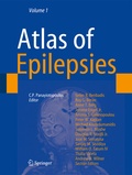 Cover: Atlas of Epilepsies - Springer