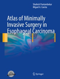 Abbildung von: Atlas of Minimally Invasive Surgery in Esophageal Carcinoma - Springer