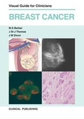 Cover: Breast Cancer - Clinical Publishing,an imprint of Atlas Medical Publishing Ltd