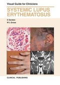 Cover: Systemic Lupus Erythematosus - Clinical Publishing,an imprint of Atlas Medical Publishing Ltd