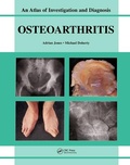 Cover: Oesteoarthritis - Clinical Publishing,an imprint of Atlas Medical Publishing Ltd