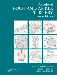 Abbildung von: Atlas Foot and Ankle Surgery - CRC Press
