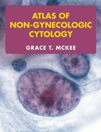 Abbildung von: Atlas of Non-Gynecologic Cytology - CRC Press