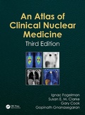 Cover: Atlas of Clinical Nuclear Medicine - CRC Press