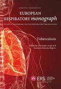 Cover: Tuberculosis - European Respiratory Society
