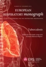 Cover: Tuberculosis - European Respiratory Society