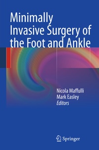 Abbildung von: Minimally Invasive Surgery of the Foot and Ankle - Springer