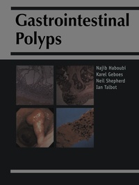 Abbildung von: Gastrointestinal Polyps - Greenwich Medical Media Ltd