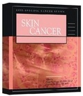 Cover: Skin Cancer - Oncology Nursing Society
