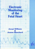 Cover: Electronic Monitoring of Fetal Heart - Books for Midwives